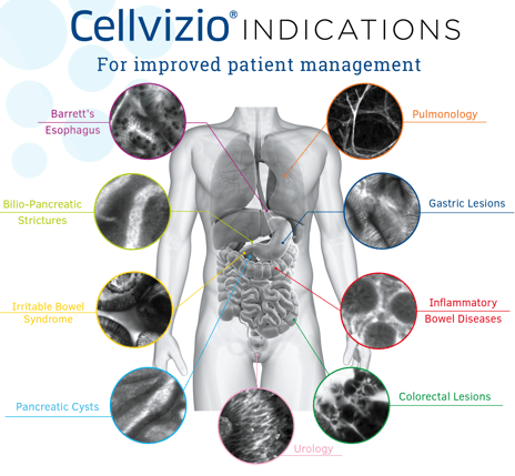Indications