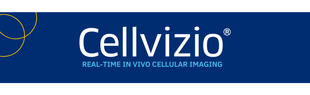 Cellvizio, real-time in vivo cellular imaging