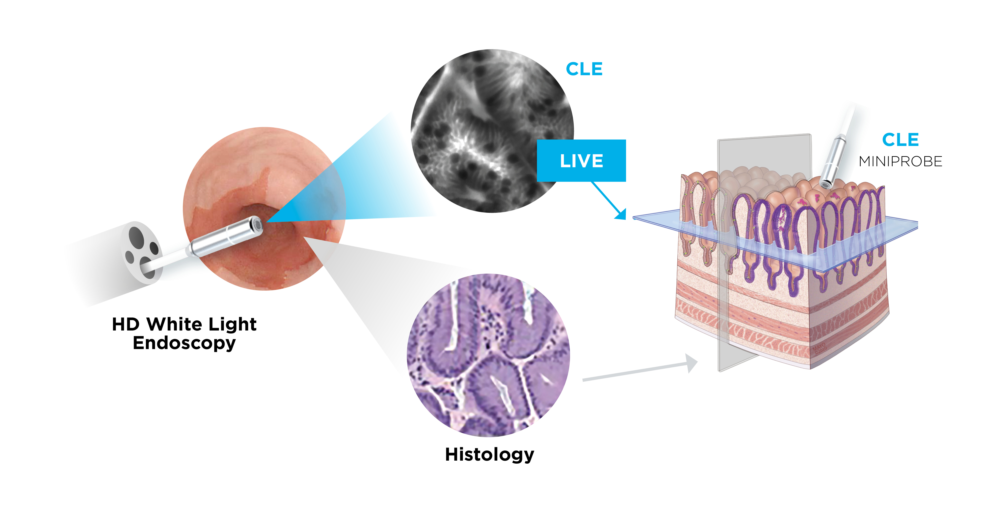 CLE Technology